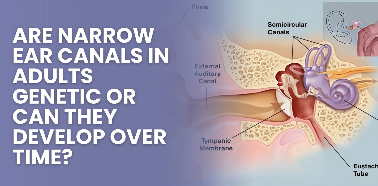 Blog thumbnail with text- Are Narrow Ear Canals in Adults Genetic or Can They Develop Over Time?